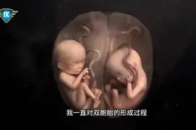 #双胞胎行成过程#见证双胞胎的奇妙旅程，生命就是奇迹！视频封面