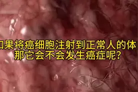 如果将癌细胞注射到正常人的体内，那它会不会发生癌症呢？视频封面
