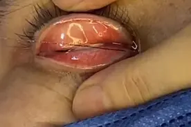 沉侵式体验通泪腺视频封面