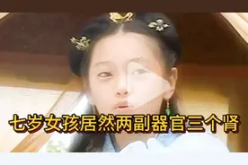 四川七岁女娃娃居然身上长了两副器官三个肾是变疫还是畸形？视频封面