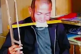 无麻药钢锯断腿，河北硬汉郑艳良！视频封面