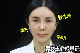 美女主播滤镜下的“假鼻”怎么修复妈生？视频封面