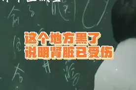 倪海厦：这个地方黑了，说明肾脏已受伤视频封面