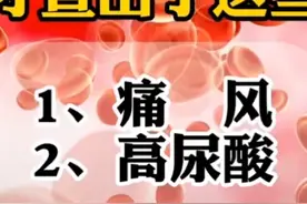 尿酸高痛风的原因视频封面