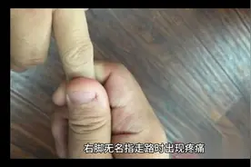 脚趾头突然疼痛的原因是…视频封面