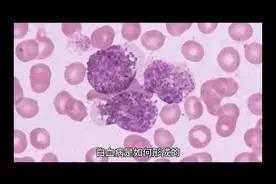 白血病是如何形成的视频封面