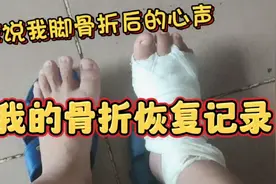 诉说我骨折后的感受心声#骨折恢复记录#脚#骨折康复#脚背#脚掌视频封面