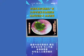 快来看👀绿色的耳屎💚和千疮百孔的耳道👂🏻视频封面