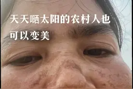 美容院私人定制批发零售各种院线款祛斑套盒祛斑美白去除痘印修护视频封面