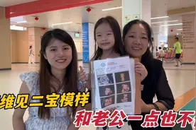 媳妇24周做四维检查，第一次看见二宝长相，大鼻子短脸都说像妈妈视频封面