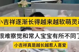 小吉祥竟然越长越软萌灵动，很难察觉和正常宝宝有所不同视频封面