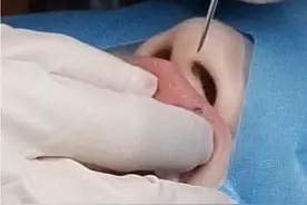 徒手穿虎牙钉