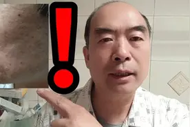 皱纹怕一物，60岁大叔细纹满脸到平坦，就做对了一件事视频封面