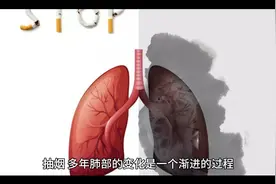 吸烟肺部的变化#戒烟的变化 #吸烟有害健康视频封面