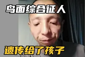 横店演员阿凡达是鸟面综合征人，孩子也被遗传到视频封面