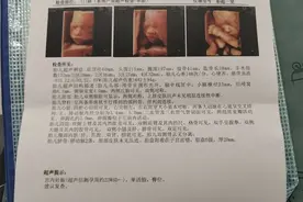 私立医院做的四维，每个部位都耐心讲解手脚指头啥都数的清清楚楚视频封面