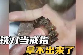 手贱拿铣刀当戒指，这手指还有救吗？视频封面
