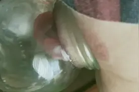 自已拔罐治疼痛《今天是拔罐后第三天看看效果如何》视频封面