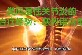类风湿性关节炎的治疗经验：寒热错杂型视频封面