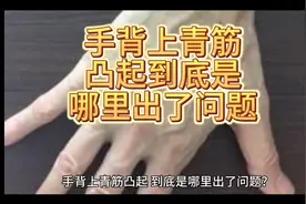 手背上青筋凸起到底是哪里出了问题视频封面