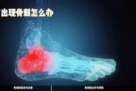 揭秘骨刺成因：为何关节长出“小刺视频封面