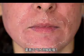 藿香正气水泡脚能瘦？视频封面