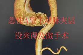 急性A型主动脉夹层，就是这么可怕!生命，就是这么脆弱!看着生命就在眼前流逝却毫无办法，真的是无奈可惜!#主动脉夹层 #抖出健康知识宝藏 #医疗健康创作训练营 #开工去班味健康指南 #内容启发搜索视频封面