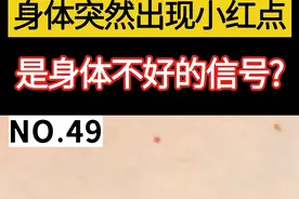 身体突然出现小红点，是身体不好的信号吗?#医学科普 #健康科普 #老年人 视频封面