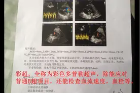 多普勒是个啥？医生的话我怎么听不懂？ #健康  #体检  #彩超视频封面