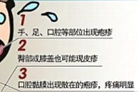 手足口疱疹从确诊到发疹，到落疹的过程…视频封面