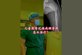 儿童股骨近端病理骨折怎么治疗？#健康守护计划 #股骨骨折 #骨折 #病理 #弹性髓内针视频封面