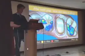 瓷睿刻 CEREC 咬合设计 椅旁CADCAM视频封面