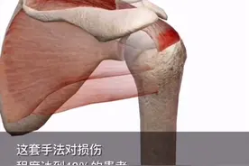 肩膀疼痛肩峰下撞击，冈上肌肌腱炎手法处理方法，非专业人士仅..视频封面