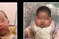 激素面霜害人不浅，肥胖性早熟出现在婴儿身上，商家太无良！视频封面