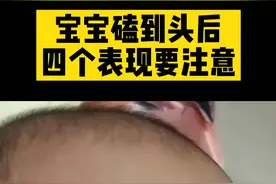 宝宝磕到头后，如果出现以下四种情况，家长要及时送医院，不可大意#健康科普  #育儿知识  #带娃日常 视频封面