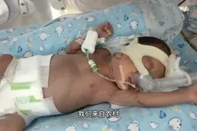 此视频告诉所有早产家庭不要轻易放弃，宝宝有我们想象不到的勇敢视频封面