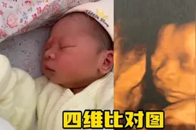 顺产头部挤压变形多久可以恢复？视频封面