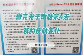 在毓璜顶医院莱山分院做完光子嫩肤已经4天了视频封面
