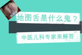 孩子得了地图舌怎么办？ #地图舌视频封面