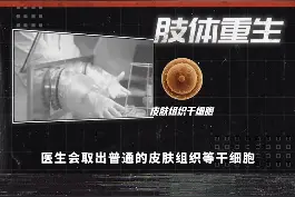 肢体再生术，是真的存在吗？ #涨知识  #科技畅想月   @抖音短视频视频封面