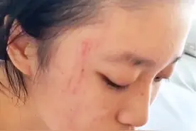 没有好的选择了，也不容许我选择了，明天出发了……希望这是菲儿的新转折点🙏大家给我点时间，为我们母女祝福好吗？#甜心儿圈圈 #单亲妈妈带娃#关爱自闭症孩子@DOU+小助手视频封面