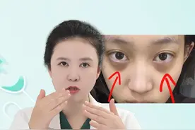 黑眼圈怎么治疗？#黑眼圈 #泪沟 #眼周抗衰 #皮肤美容 #硬核健康科普行动 @DOU+小助手视频封面