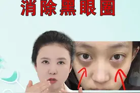 黑眼圈怎么治疗？#黑眼圈 #泪沟 #眼周抗衰 #皮肤美容 #硬核健康科普行动 @DOU+小助手视频封面