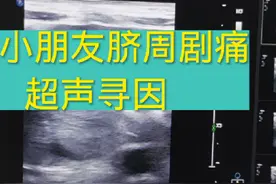 小朋友脐周剧痛超声寻因 小朋友脐周剧痛超声寻因。#医学科普视频封面