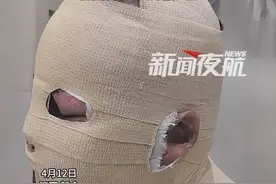 4月12日 江西 新余。记者从武汉陪杜爸爸回江西新余，杜均浩正在医院换药，他首次面对媒体，杜爸一直给儿子拍背：“轻轻拍 身上会舒服一些”。视频封面