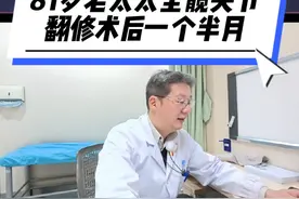 81岁老太太全髋关节翻修术后一个半月复查。#髋关节置换 #股骨头坏死 #关节置换 #髋关节发育不良 #股骨颈骨折视频封面