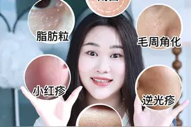 面部粗糙小颗粒❗️真正让皮肤变光滑的秘诀⚠️ #好皮肤养出来 #皮肤粗糙 #皮肤变光滑视频封面