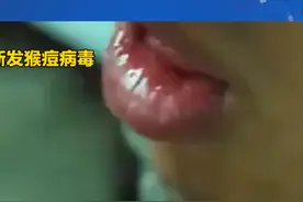 泰国出现亚洲首例猴痘变异新毒株，可通过呼吸道飞沫等传播视频封面