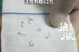 女子做痔疮手术后留隐患：10年内取出30多枚钛钉，肛门内屡发剧痛，痛苦不堪，无法过正常家庭生活 还因此离婚。法院判赔62万。#四川 #痔疮 #痔疮手术 @抖音短视频
