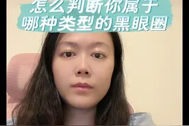 怎么判断你是哪种类型的黑眼圈？不同类型黑眼圈如何治疗？#黑眼圈 #眼袋#公立整形 #李莉洁博士 #广东医科大学附属东莞第一医院视频封面